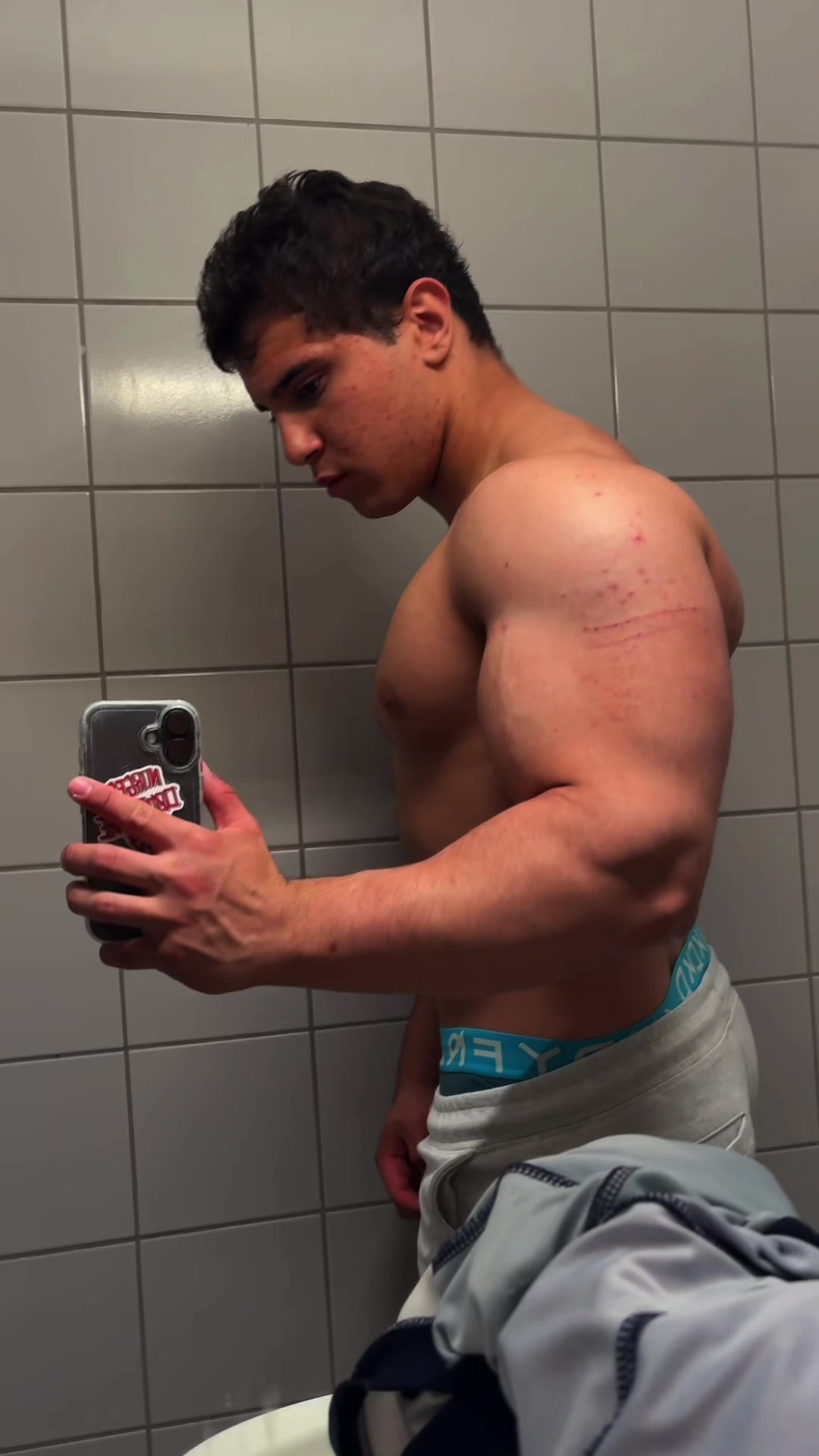 @Eliass