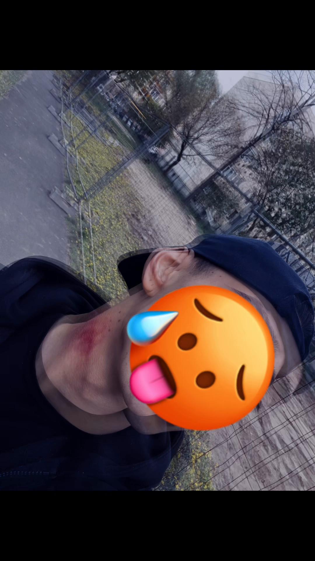 @Ro🅱️ert nagy❤️&zwj;🔥