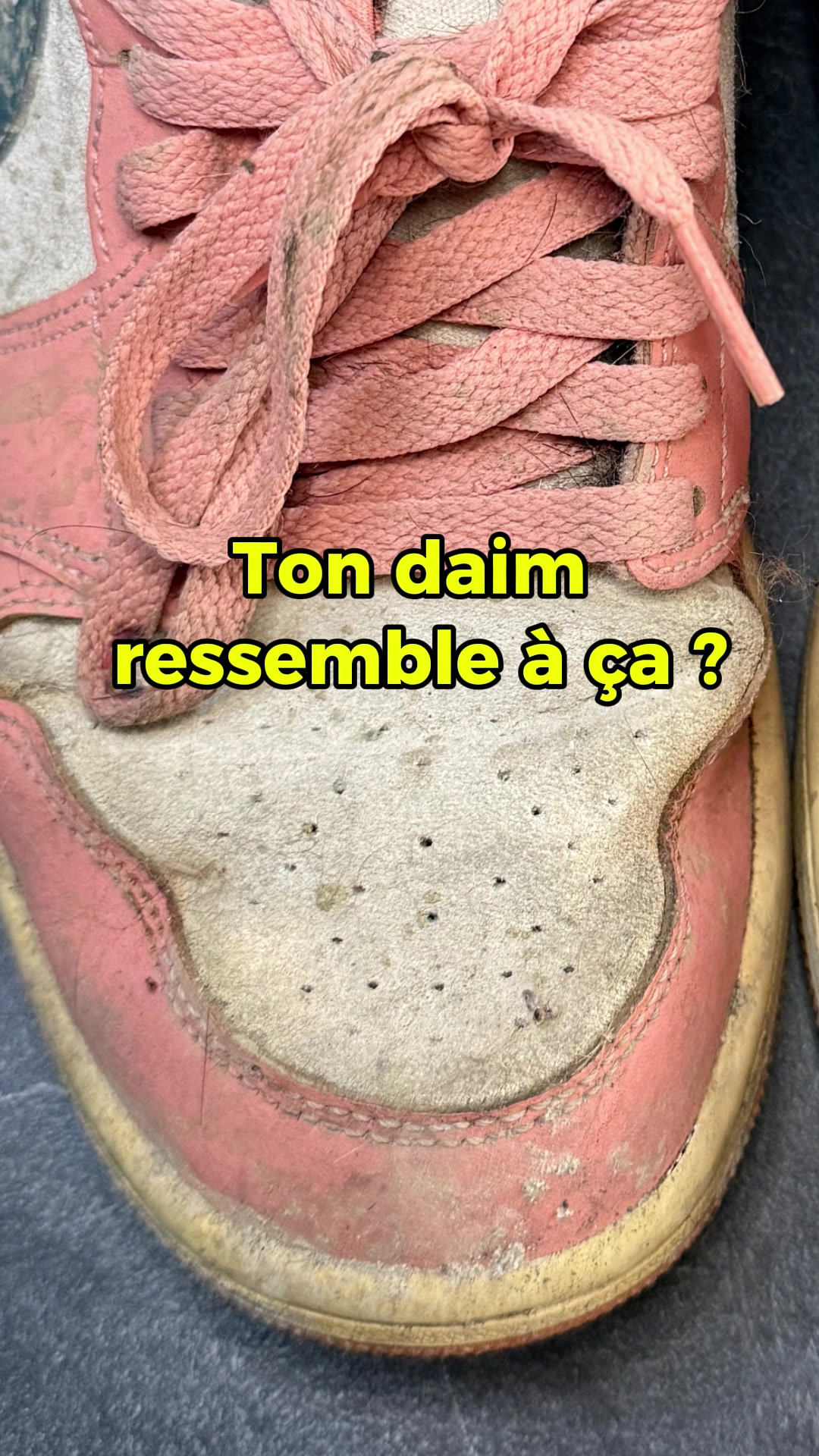 @LSBL
