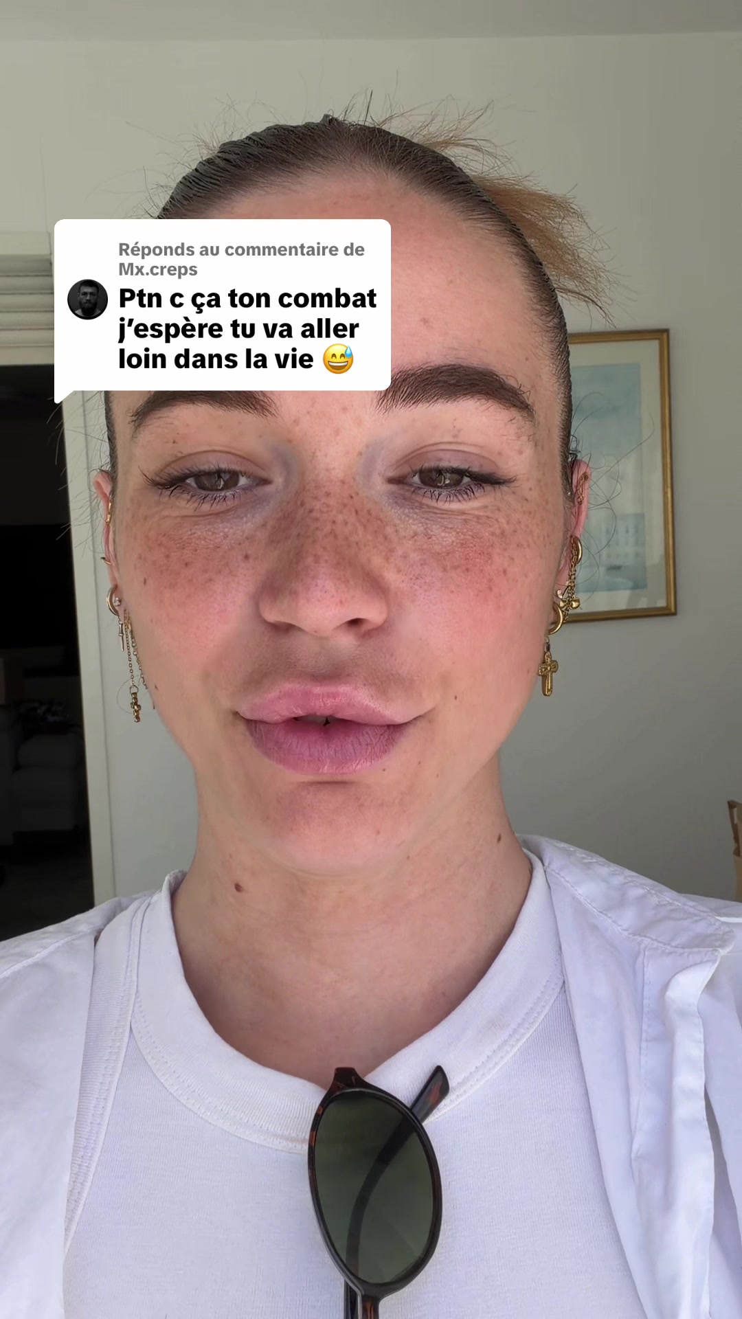 @CHL♡É 🍒