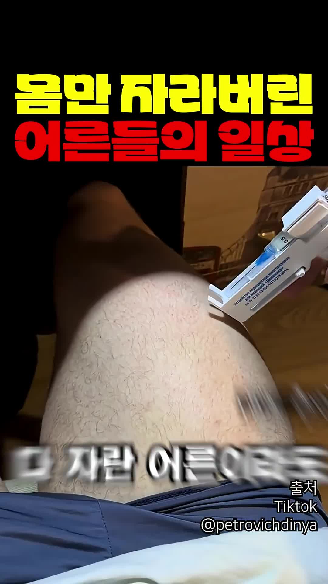 @짱아까미