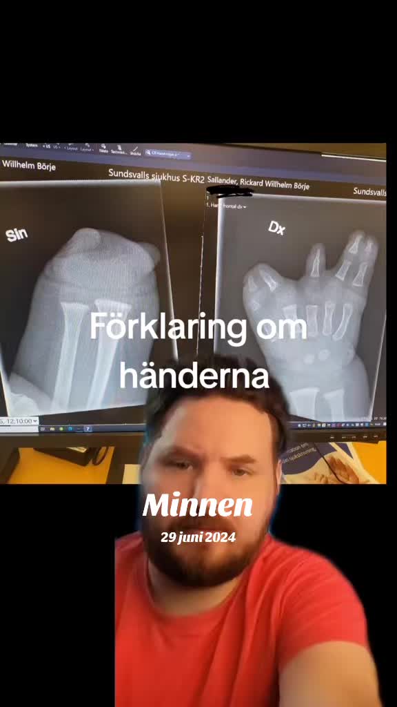 @Sallander
