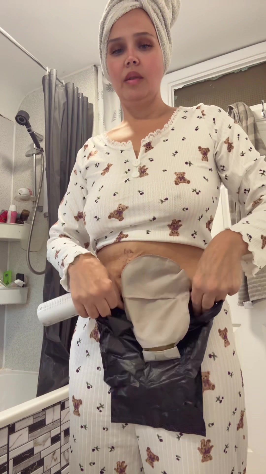 @Stoma swan awareness