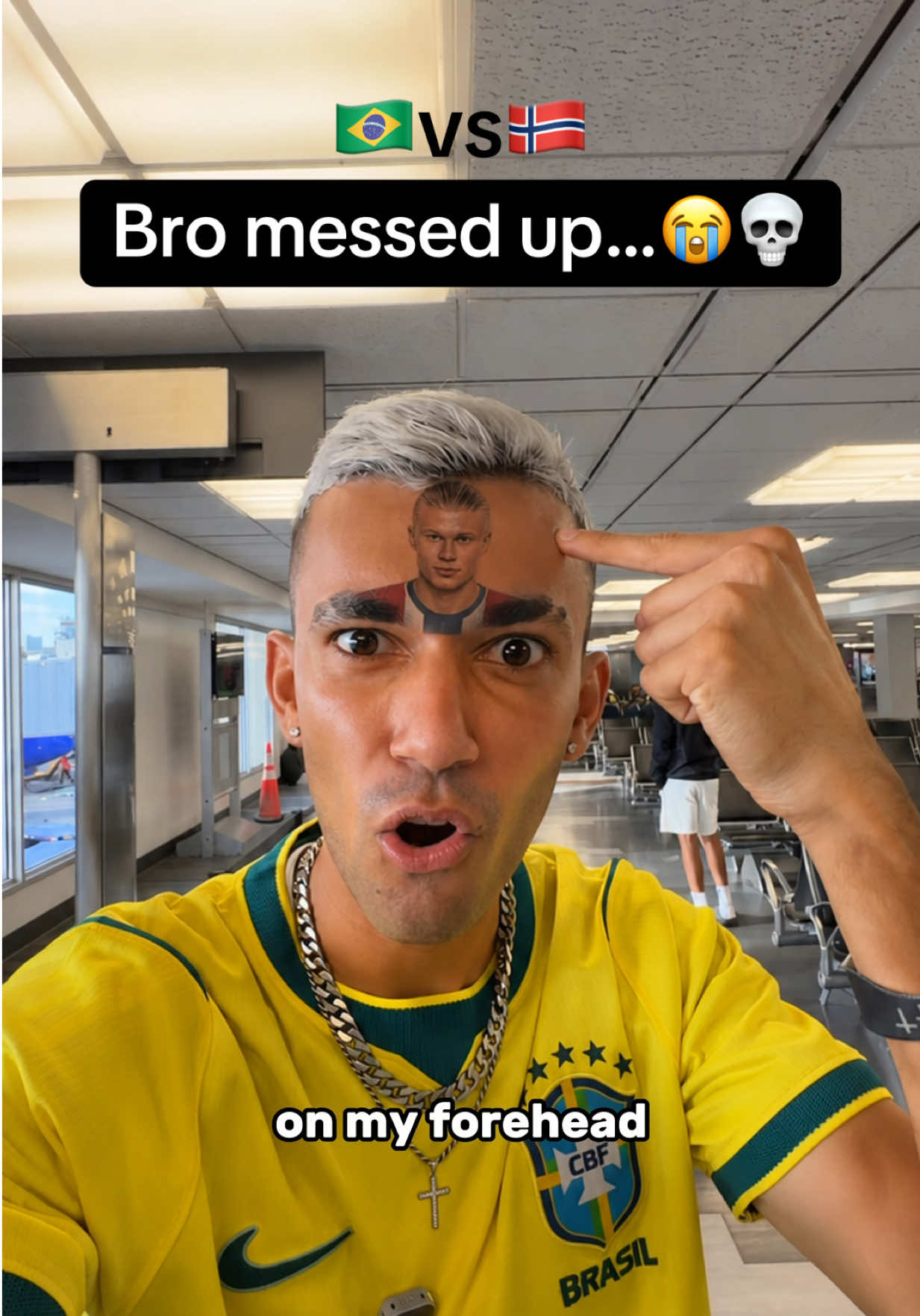 @ELASTICO KING👑