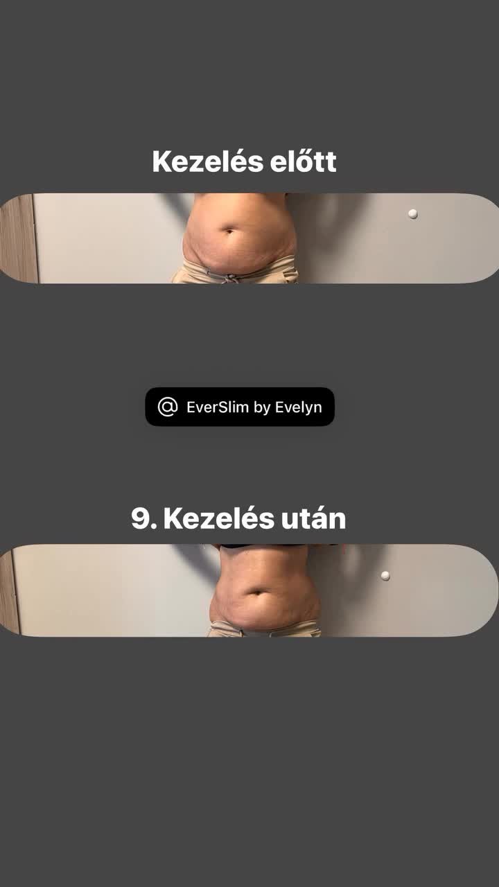 @EverSlim by Evelyn🌸
