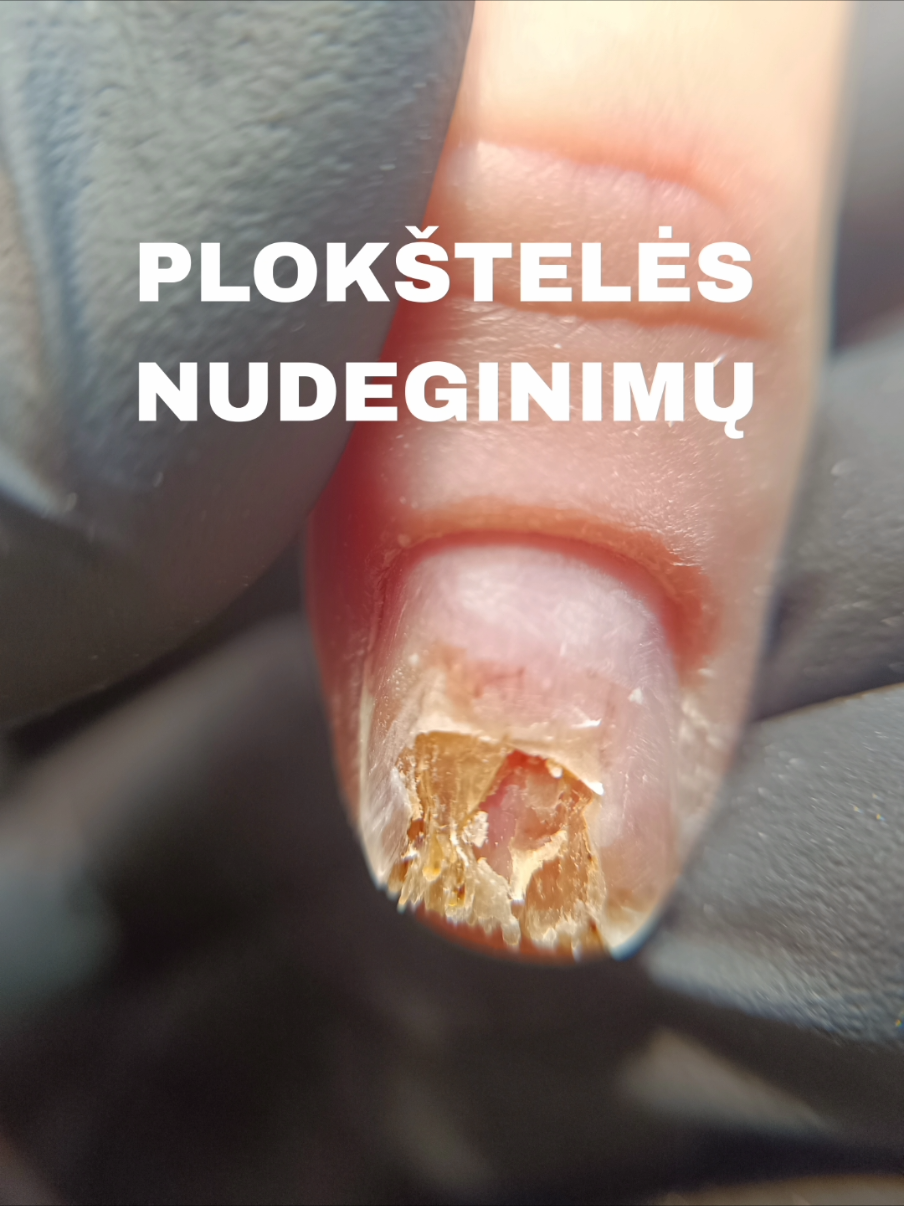 @Dovilė Zaukevičiūtė