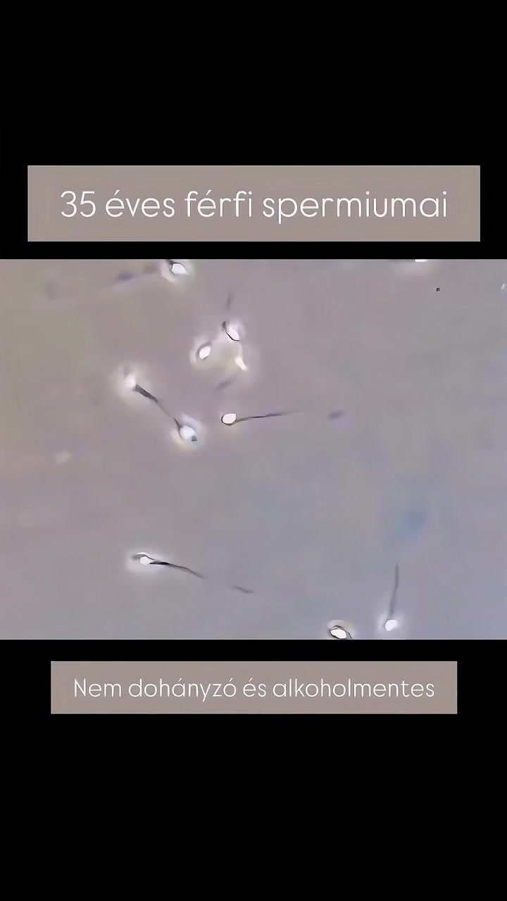 @Eker Timi | mibollesz.hu
