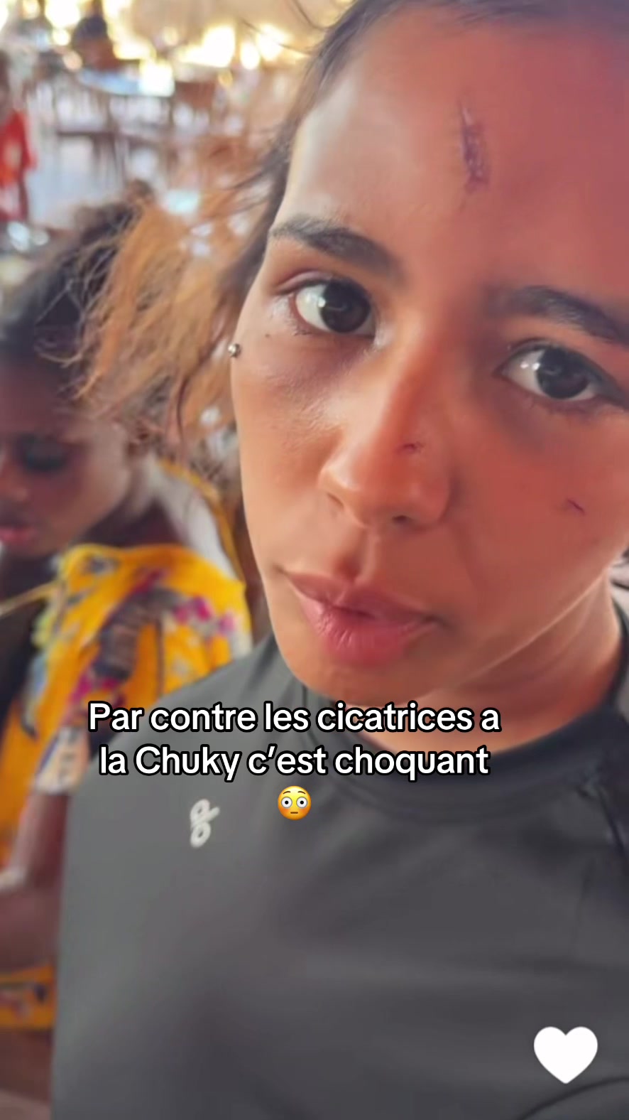 @quituveux