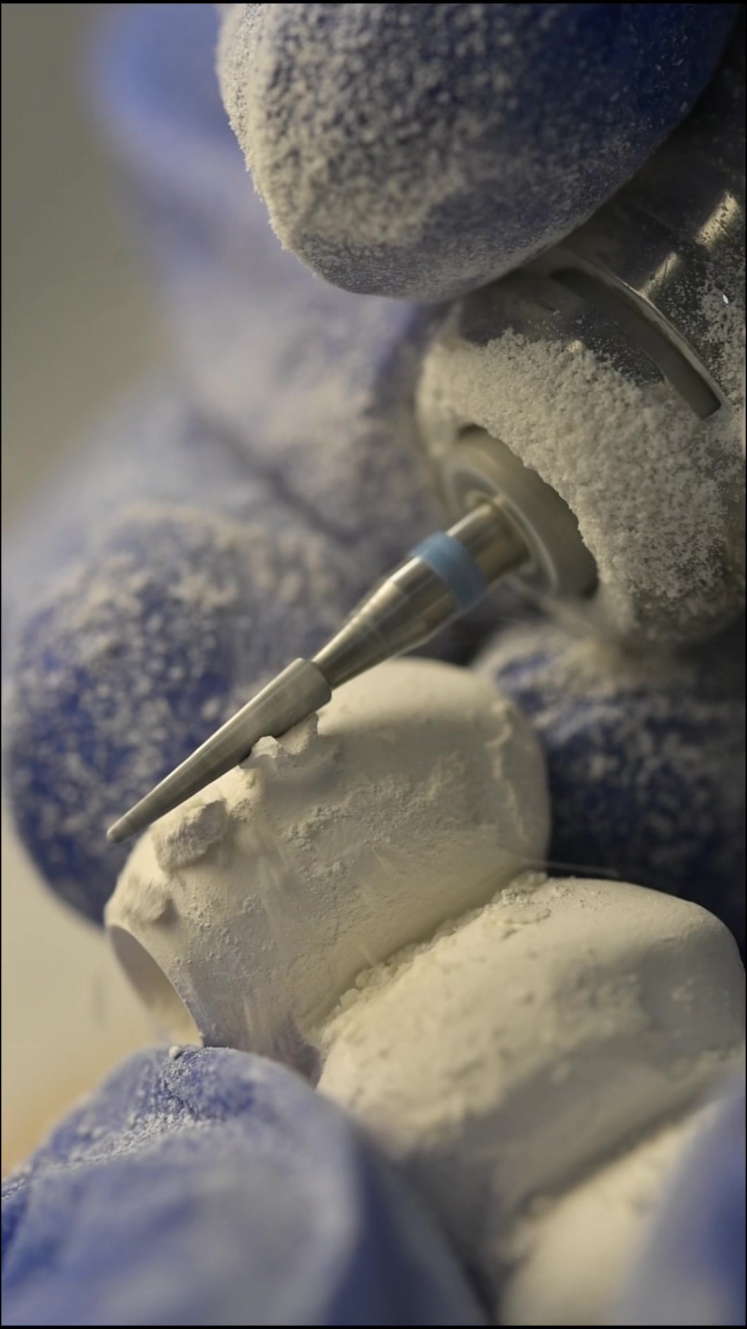 @Vivo Dental Lab