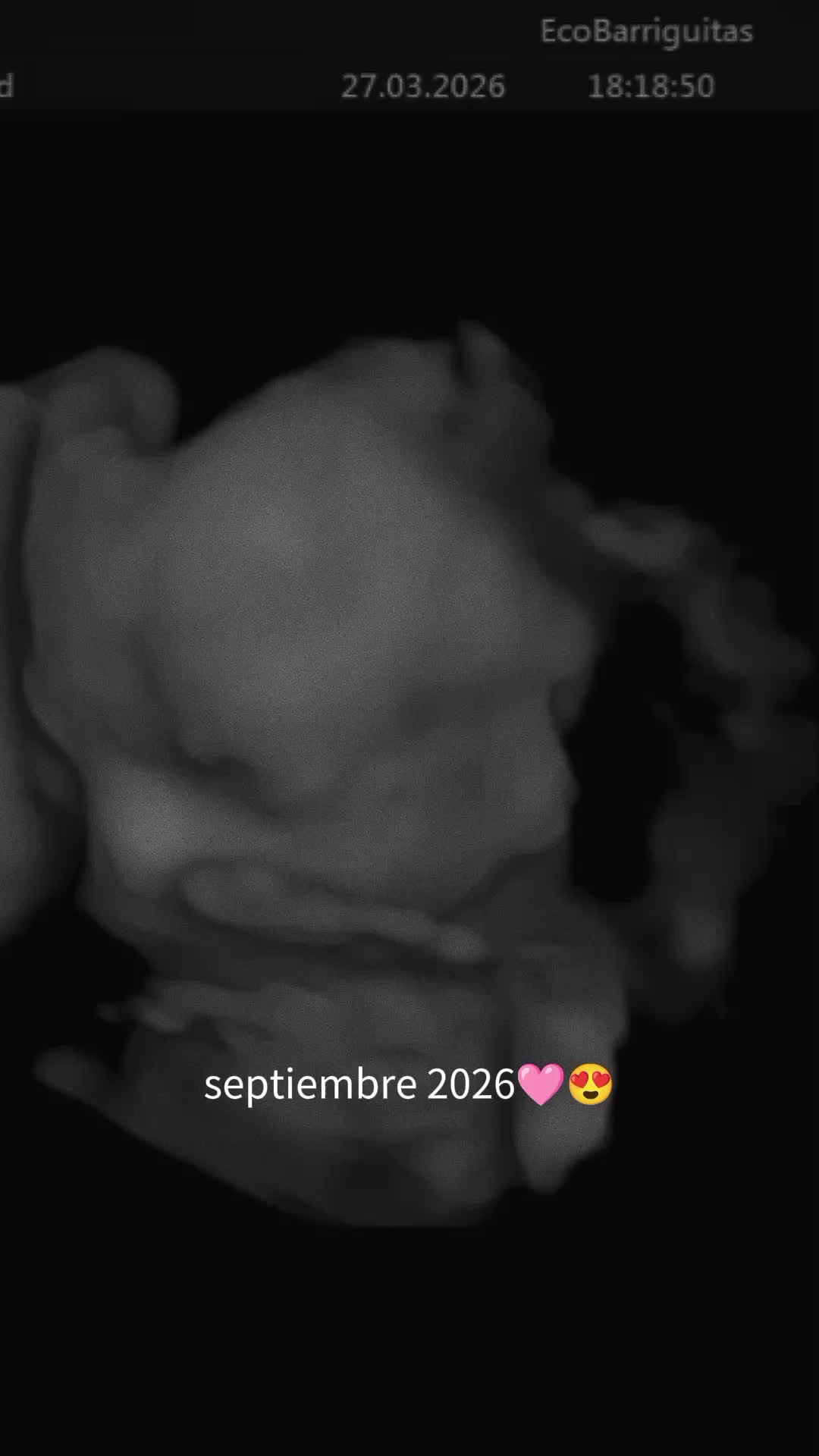 @mama_deun_principe💙👑