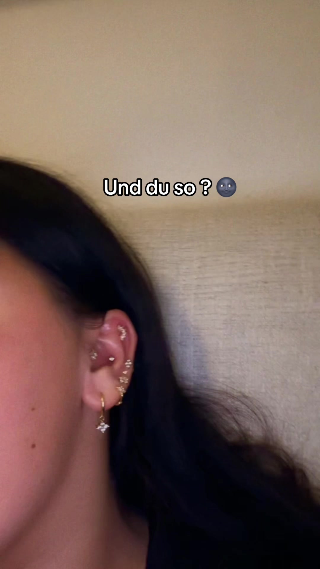 @Linoxx