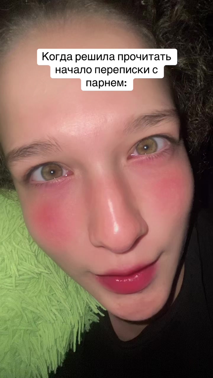 @У меня бошка из кортошки☺️