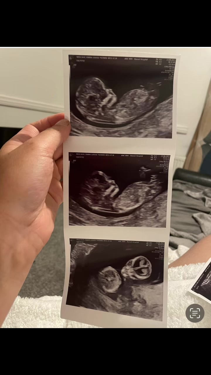 @Emma Louise xx