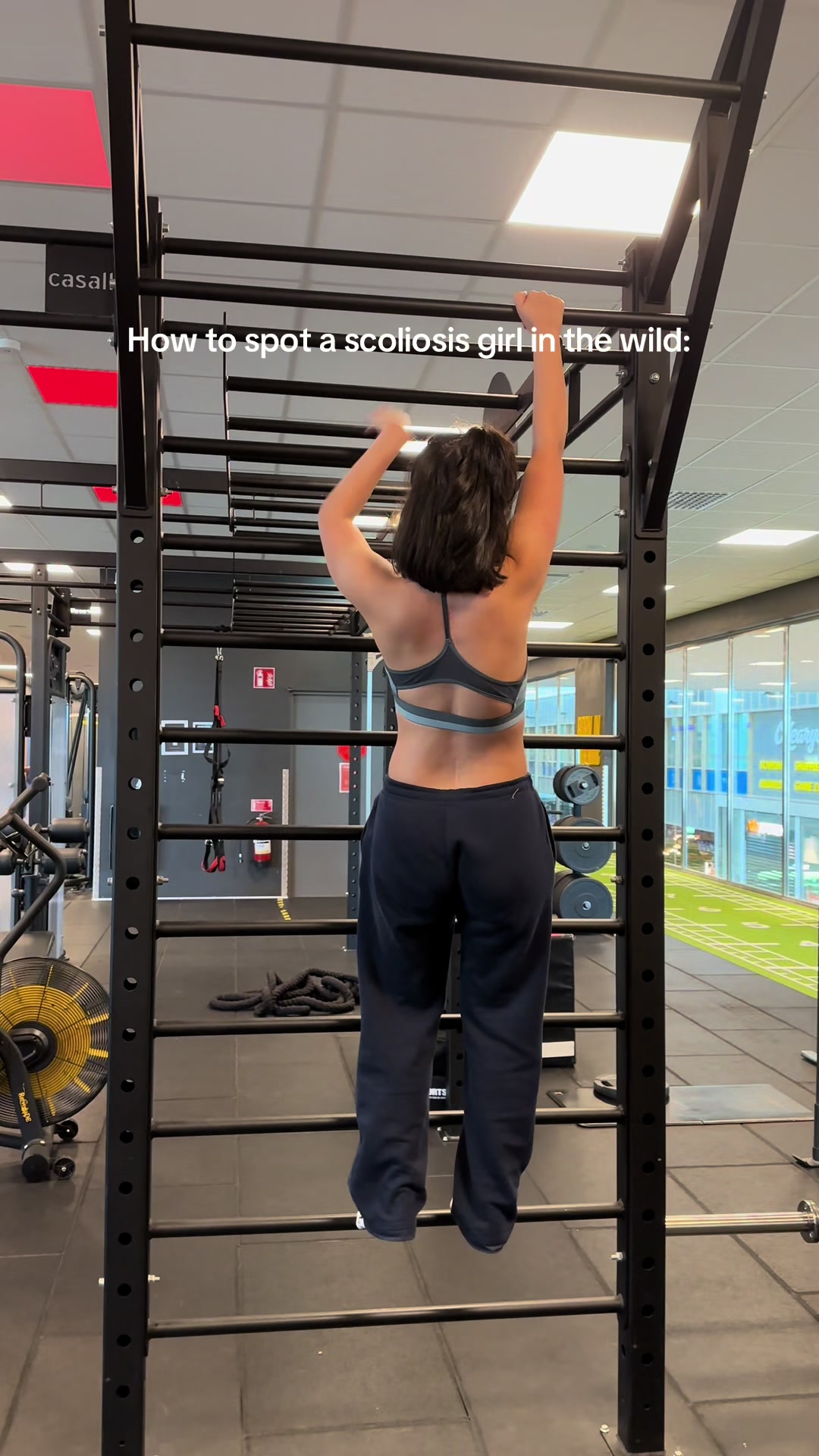 @Yasamin [Scoliosis]