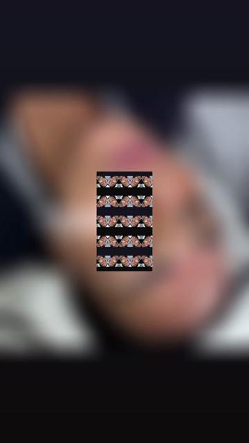@Superfacial Aesthetics