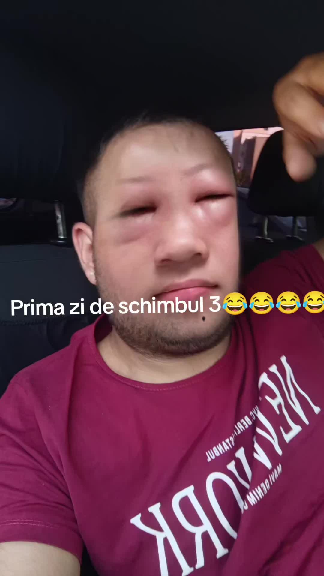 @Lale