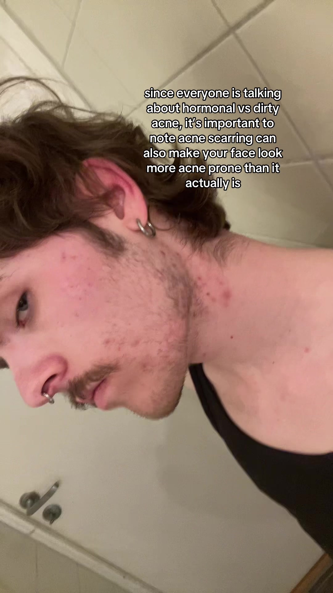 @felix