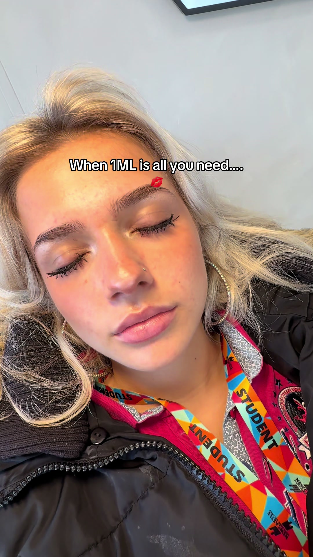 @face_ncl
