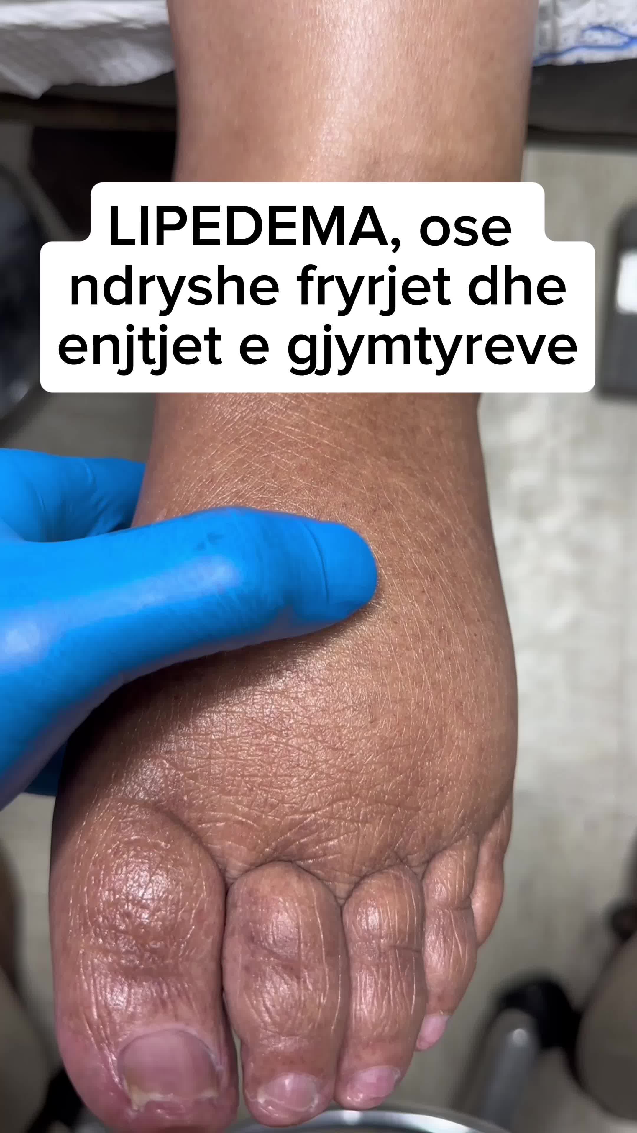@Lumar