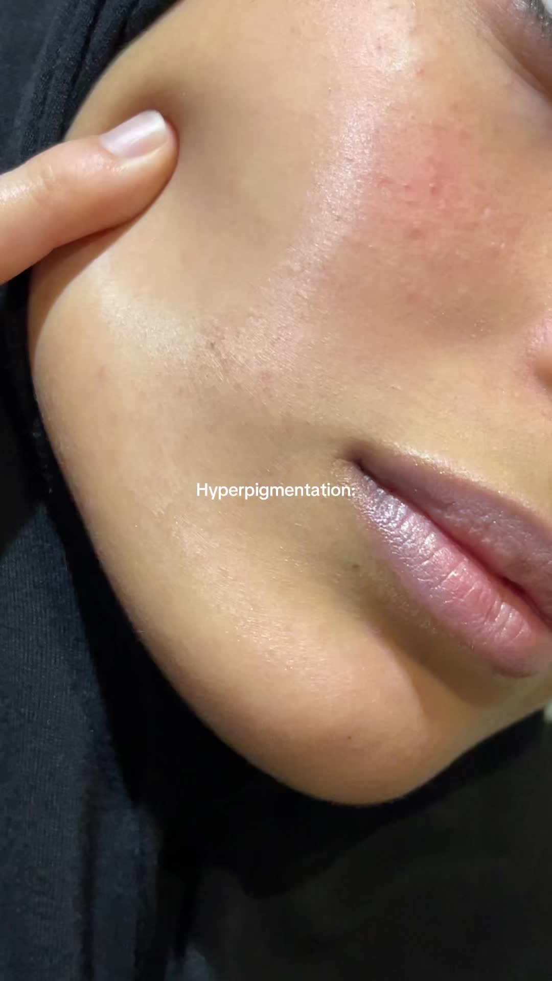 @InayaMorocco