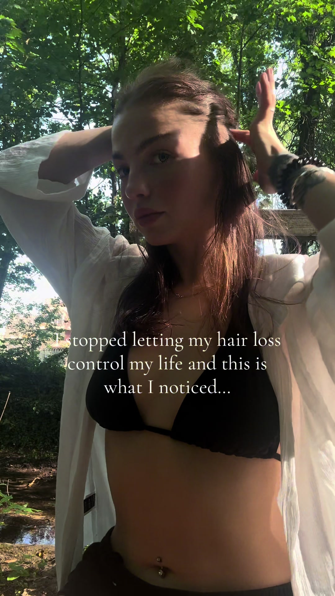 @Brooke💗Hair loss Journey