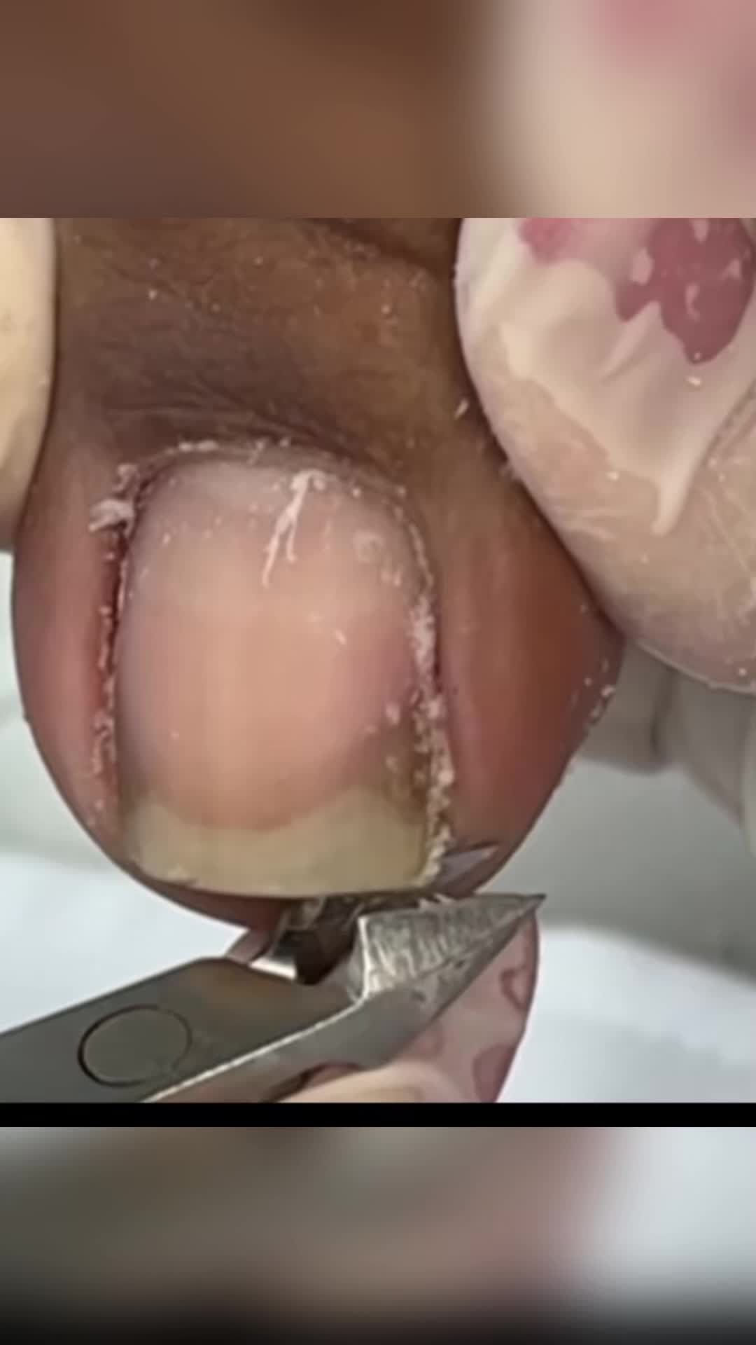 @Toenails.clips