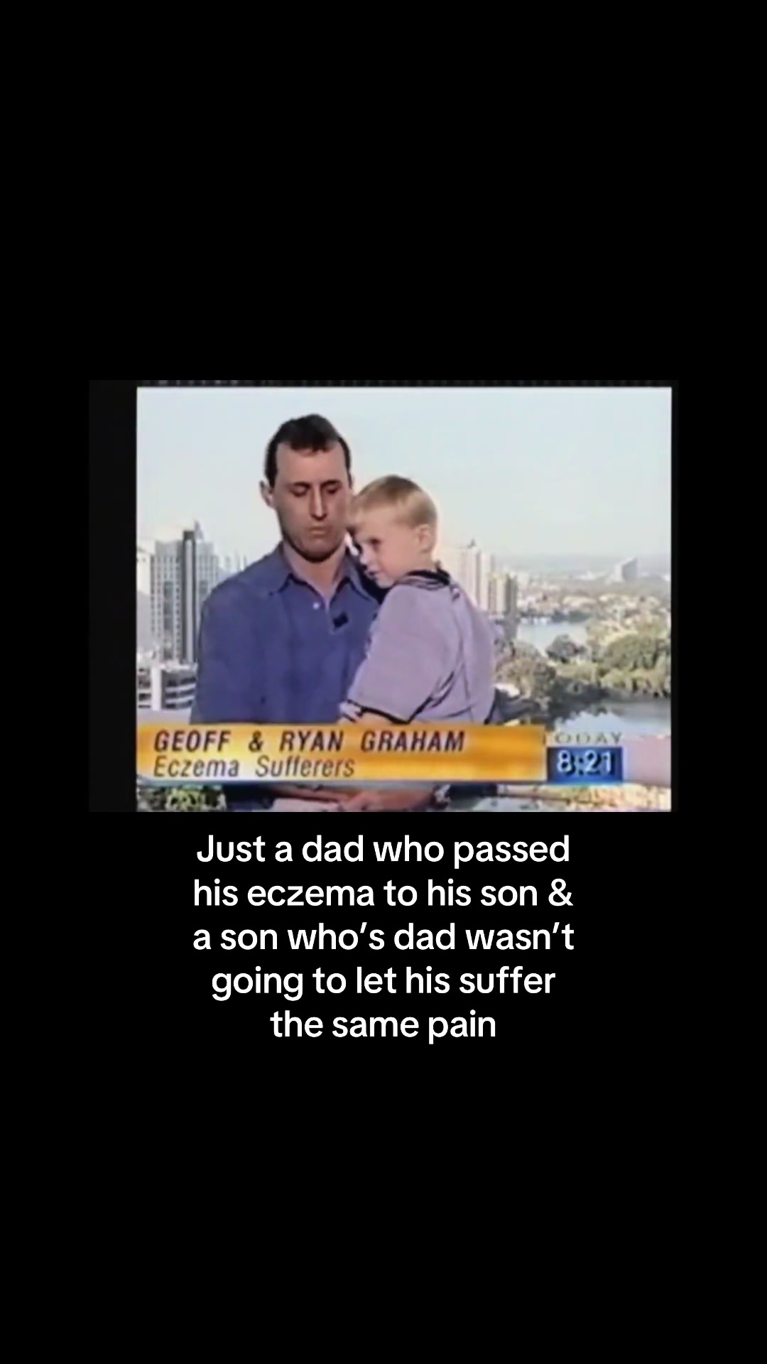 @Eczema Diaries USA & UK