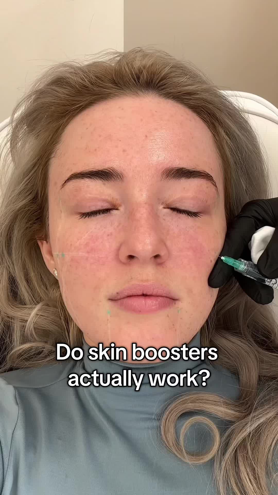 @Abigayle