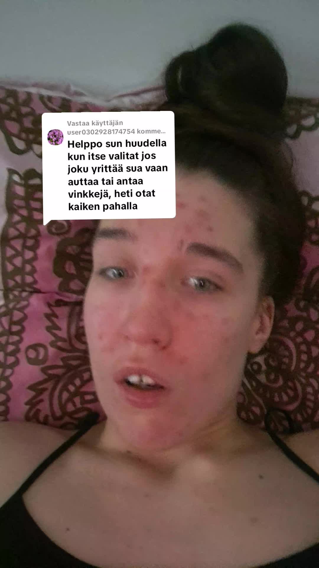 @MIRKKU❤️🔥