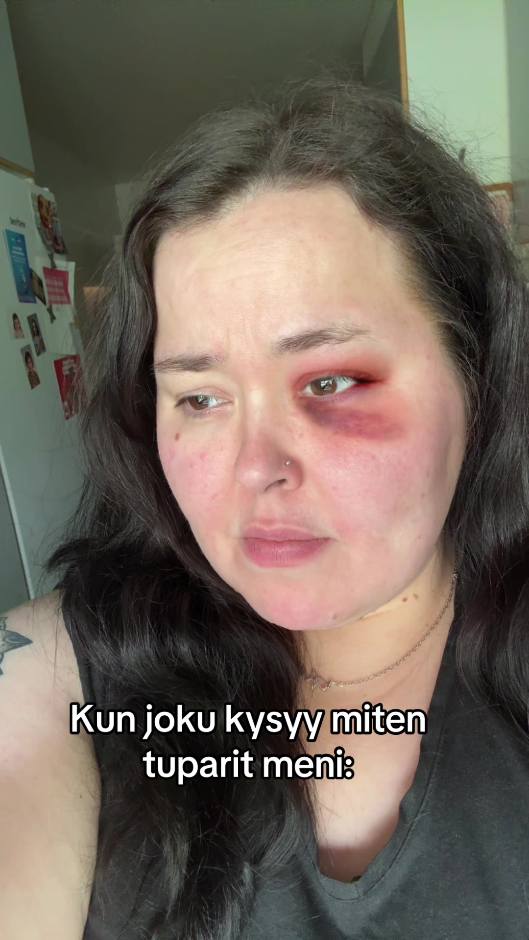 @Rakkaudella,minä 🫶🏻
