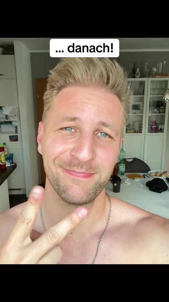 @Mr. Hairtransplant