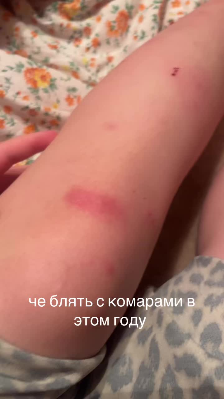 @Killer_7776