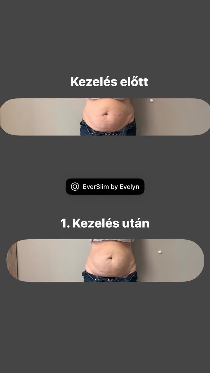 @EverSlim by Evelyn🌸