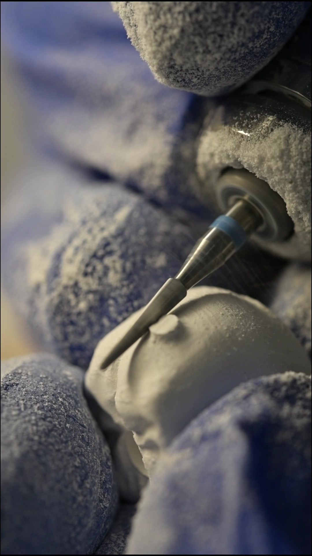 @Vivo Dental Lab