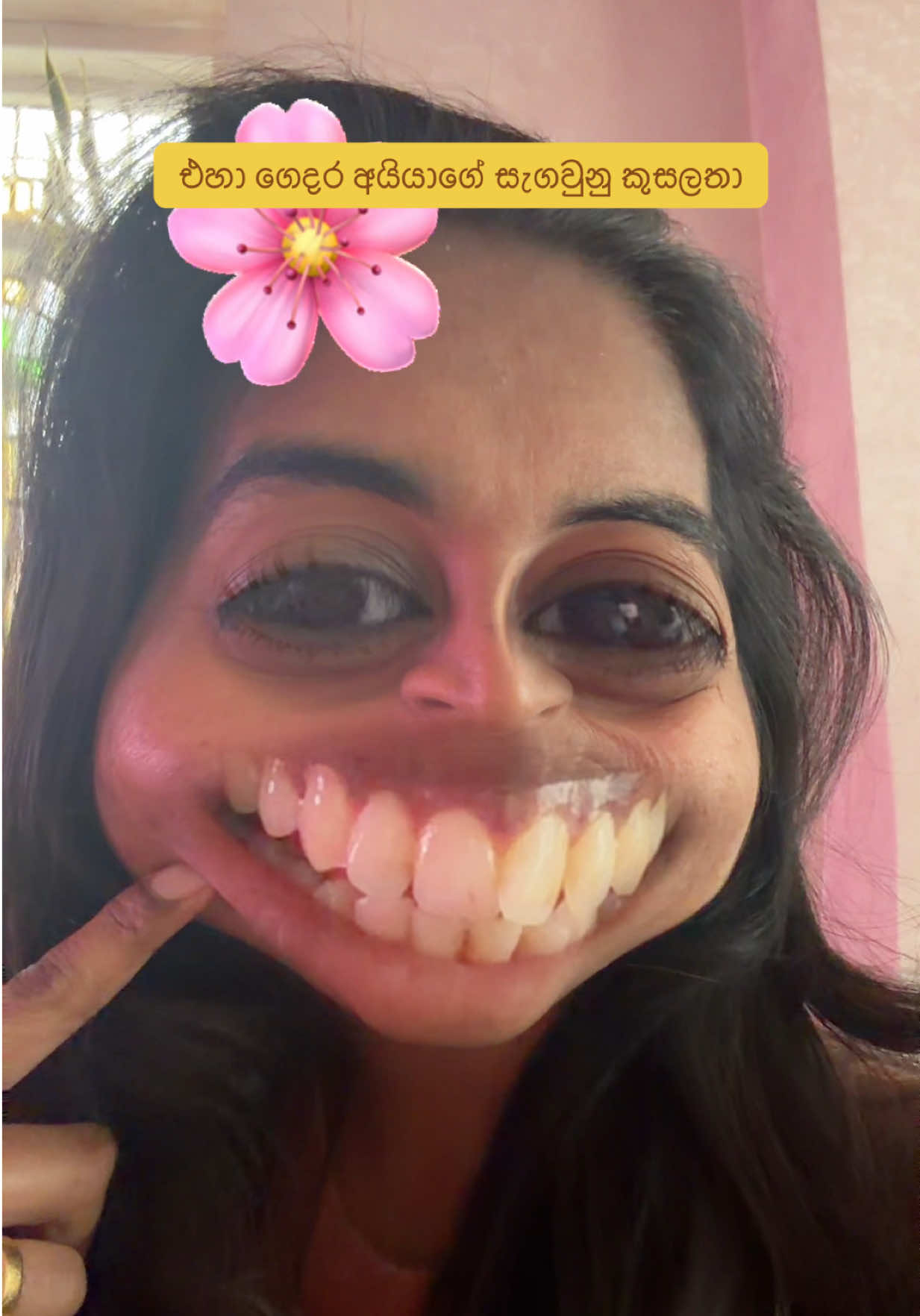 @ආදර චම්පා...