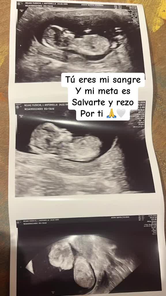 @Amtonegra