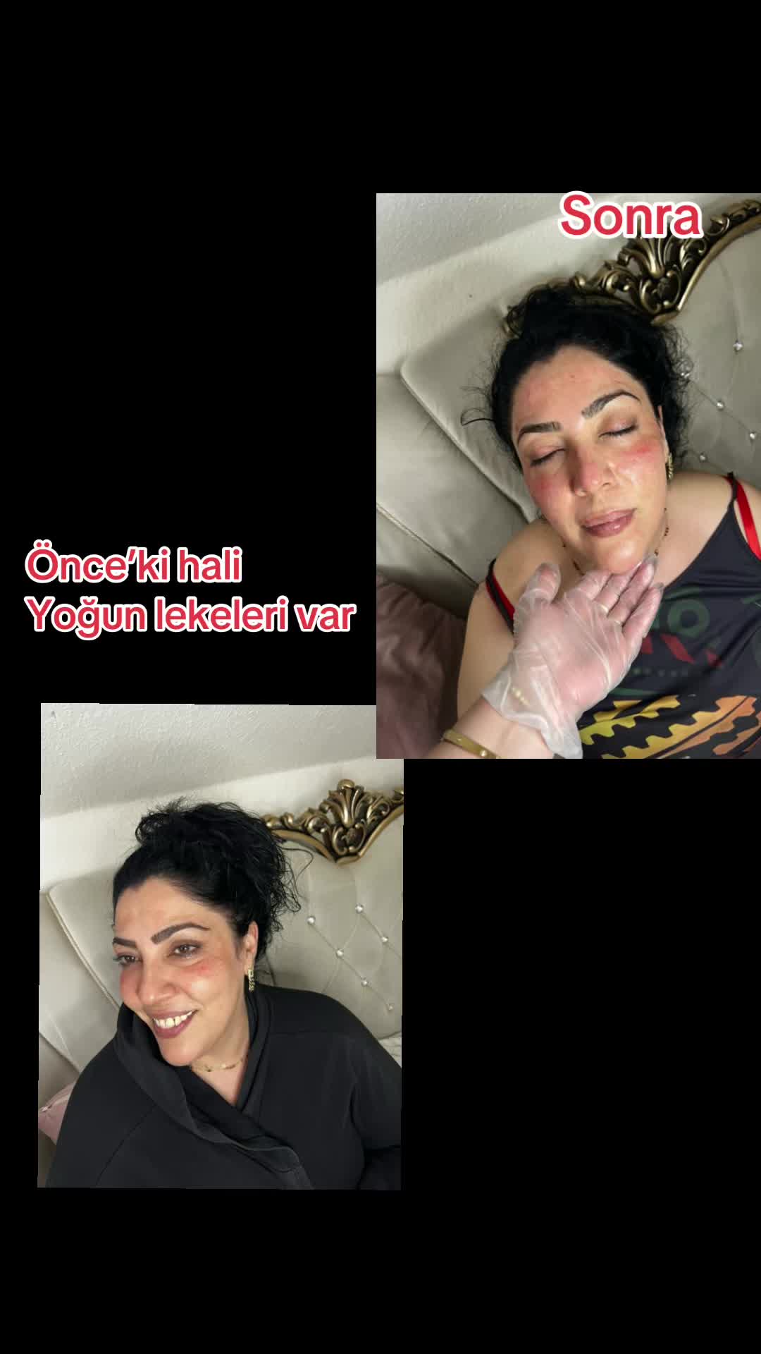 @Melis_klein✅