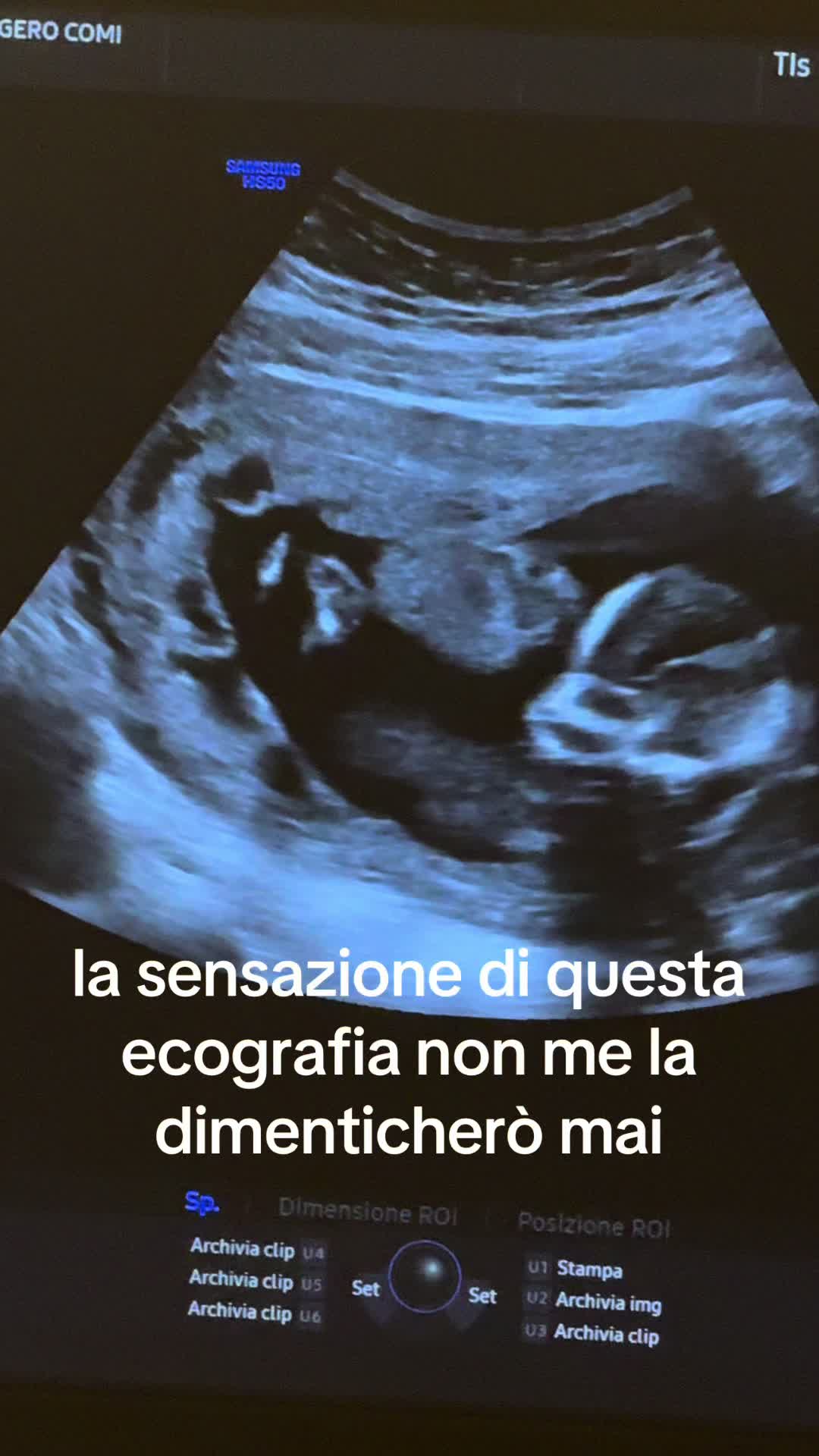 @a3nm__