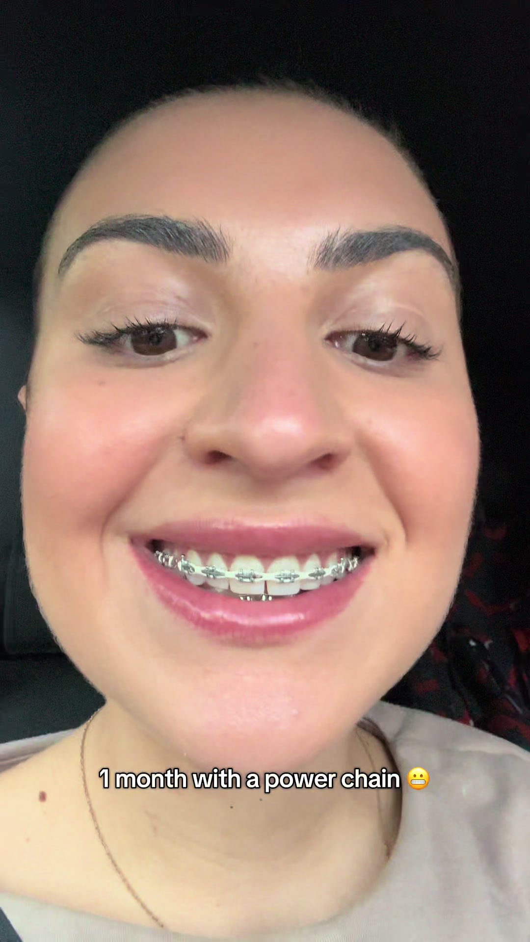 @Tillytodos