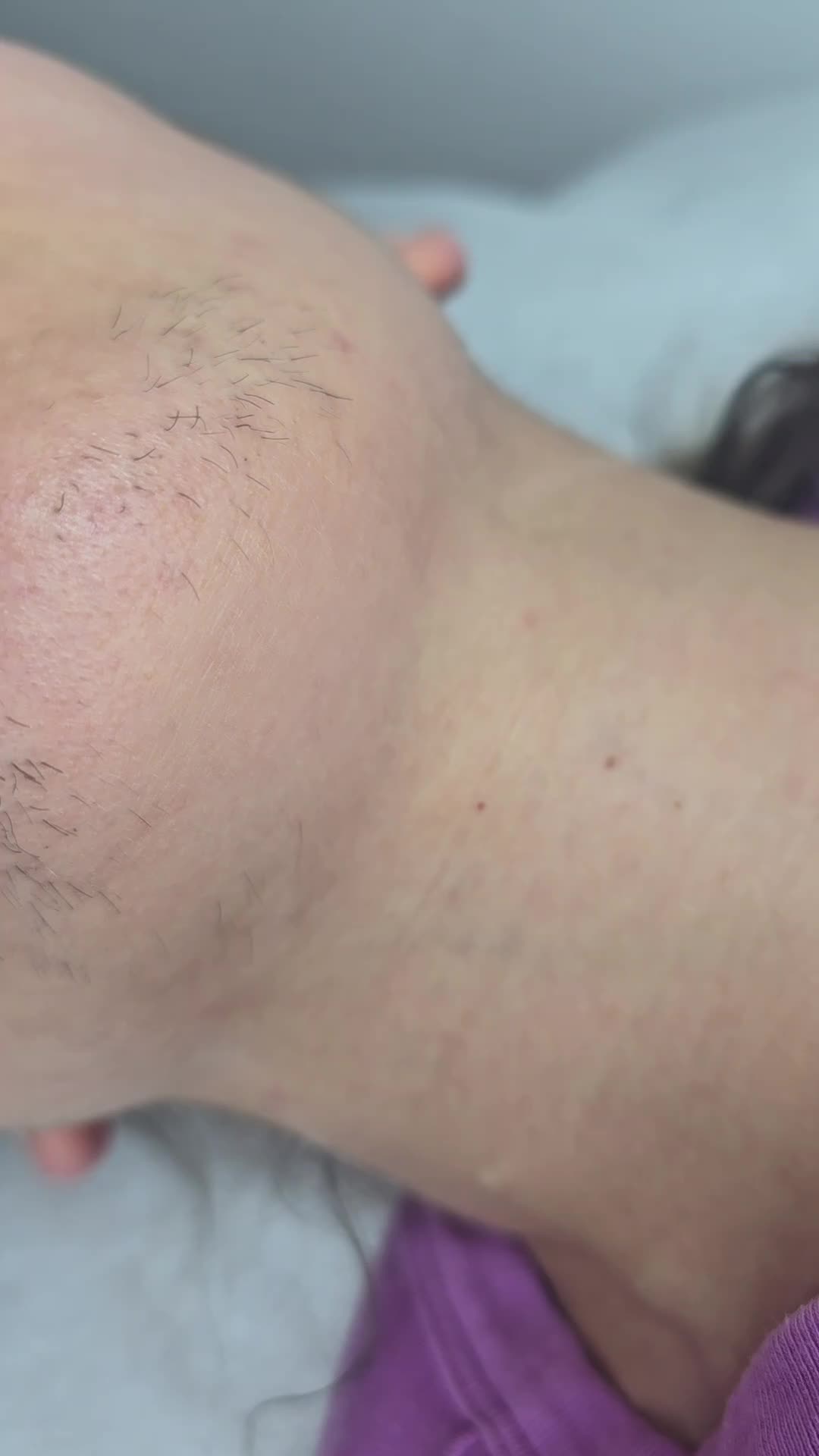 @Nadine Electrolysis.Waxing