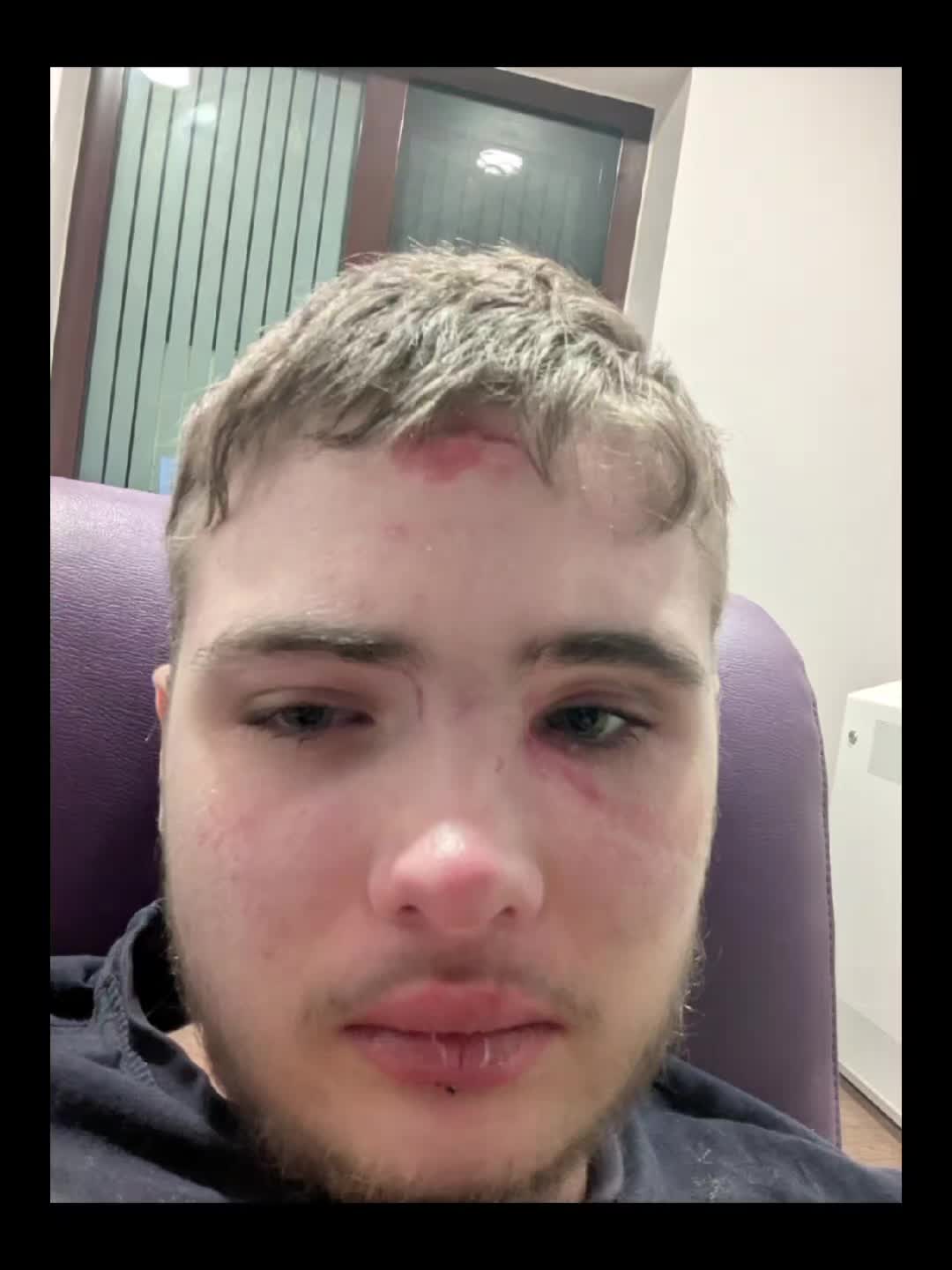 @Ryan