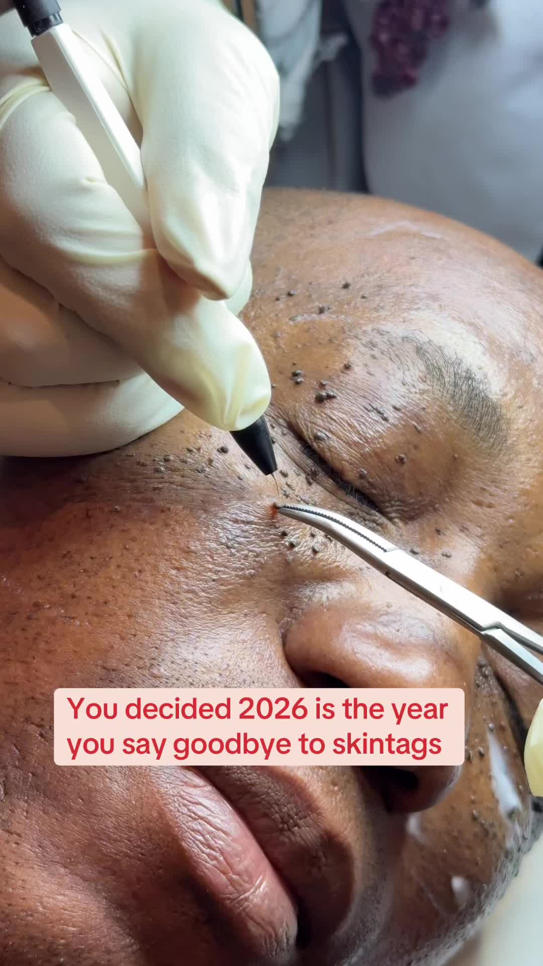 @Binsina Laser & Skin Clinic