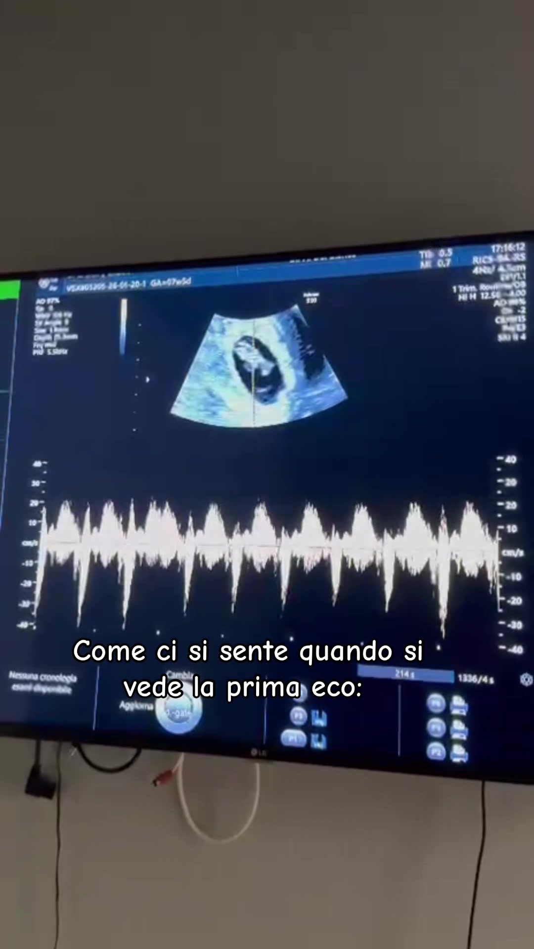 @lapugliese