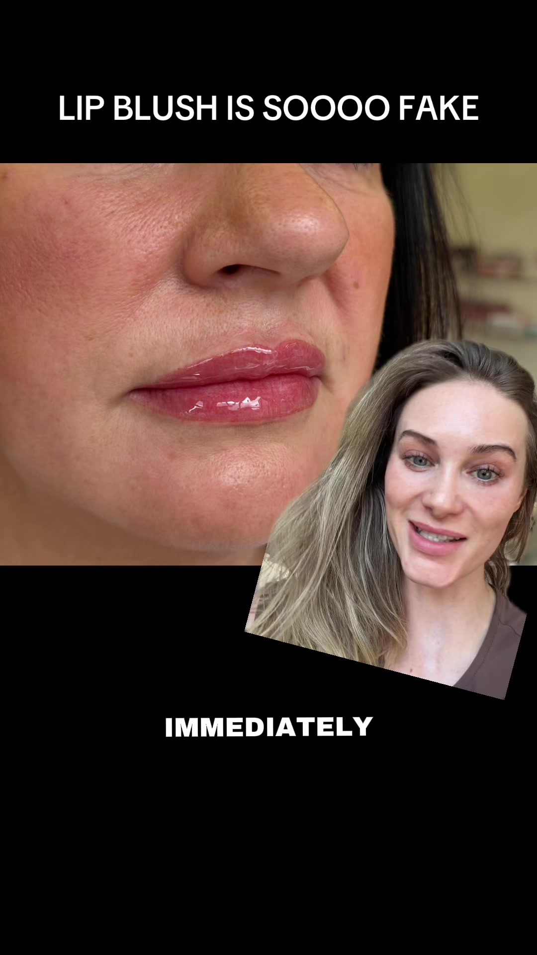 @Rebecca Teasdale | Lip Blush