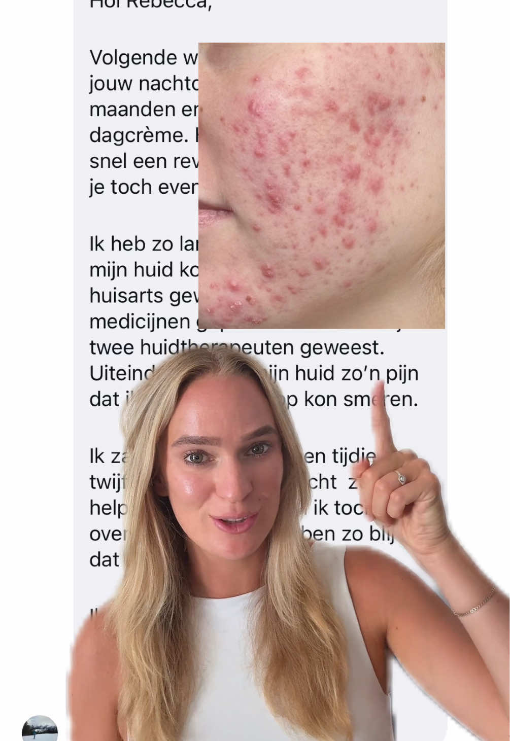 @Rebecca | Huidtherapeut✨