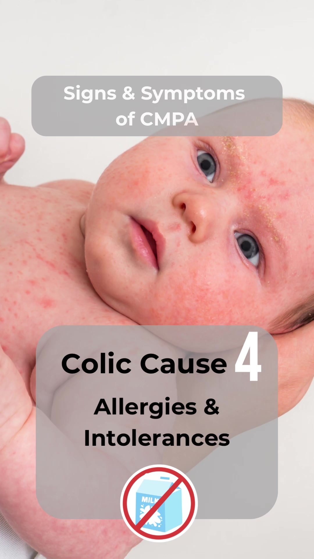@The Colic Mama