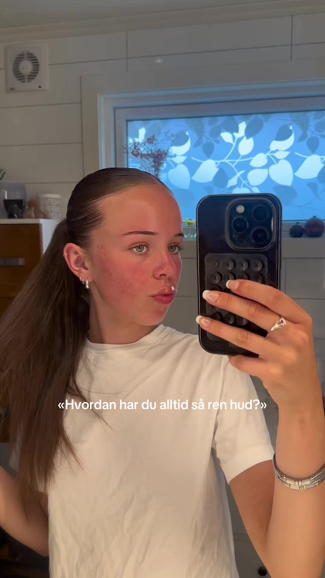 @SOFIE GJERVIK