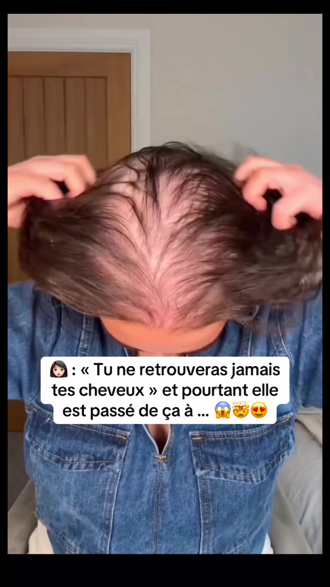 @Lux’Hair Growth