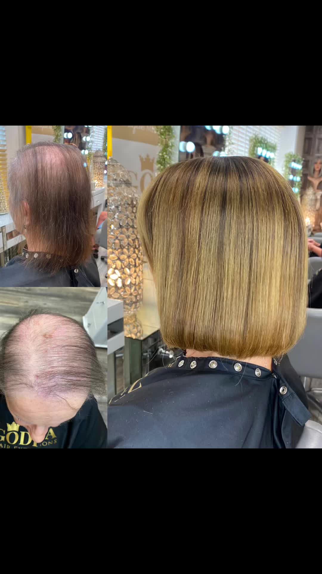 @Godiva Hair Loss Specialists