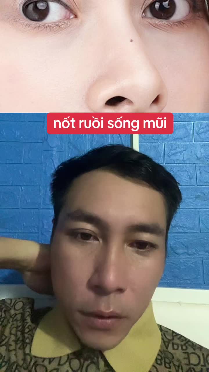 @Tuệ Nhãn ✅
